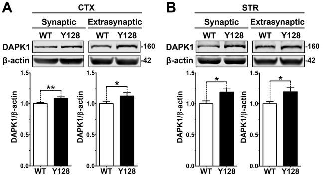 DAPK1 Antibody in Western Blot (WB)