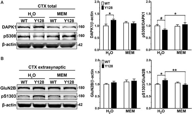 NMDAR2B Antibody in Western Blot (WB)