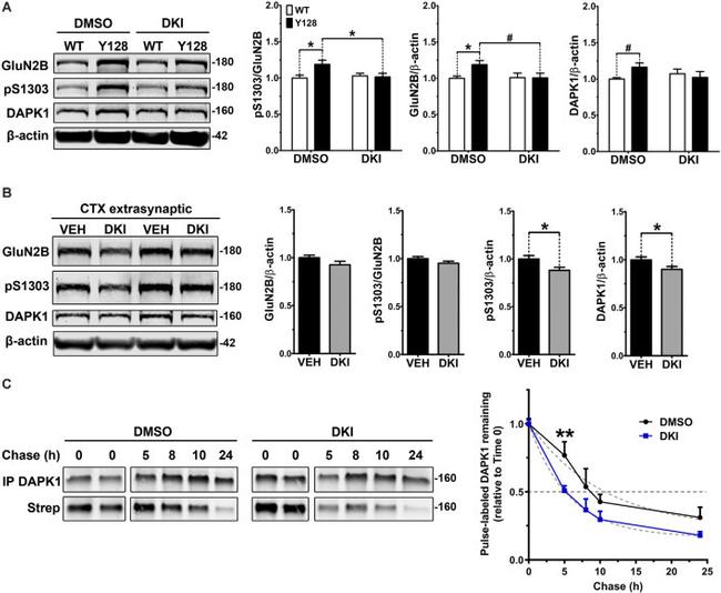 DAPK1 Antibody in Western Blot (WB)