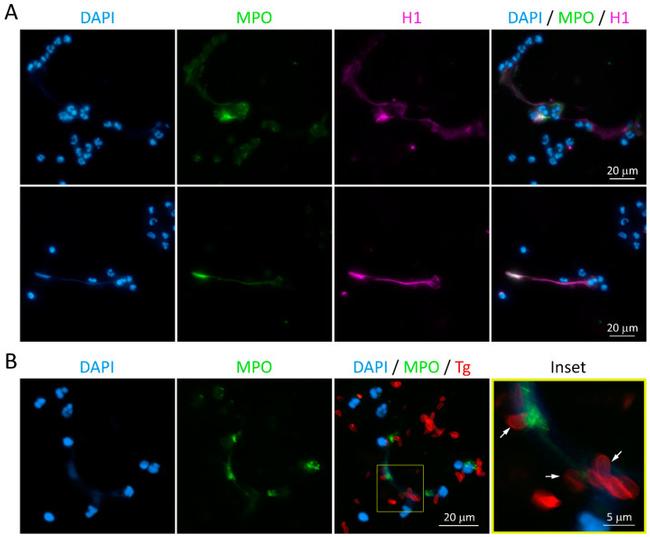 Myeloperoxidase Antibody in Immunocytochemistry (ICC/IF)