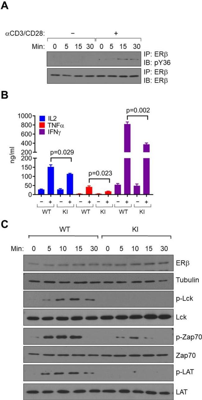 Estrogen Receptor Beta Antibody in Western Blot, Immunoprecipitation (WB, IP)