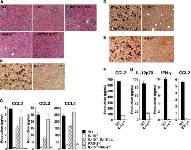 CD11c Antibody in Immunohistochemistry, Immunohistochemistry (Frozen) (IHC, IHC (F))