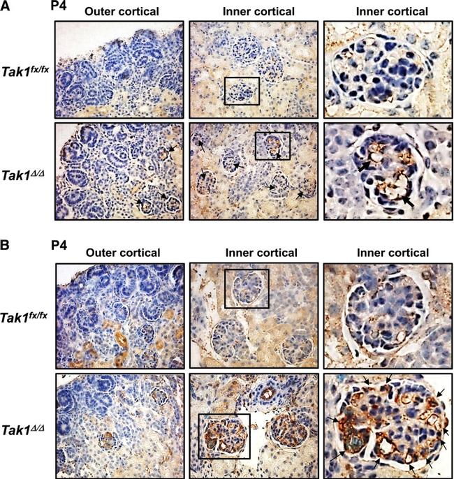 CD31 (PECAM-1) Antibody in Immunohistochemistry (IHC)