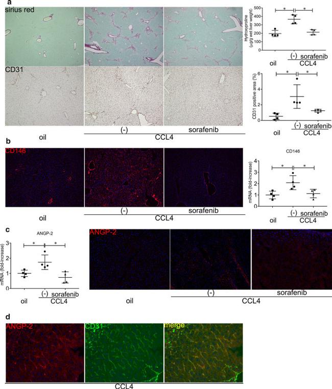 CD31 (PECAM-1) Antibody in Immunohistochemistry (Paraffin) (IHC (P))