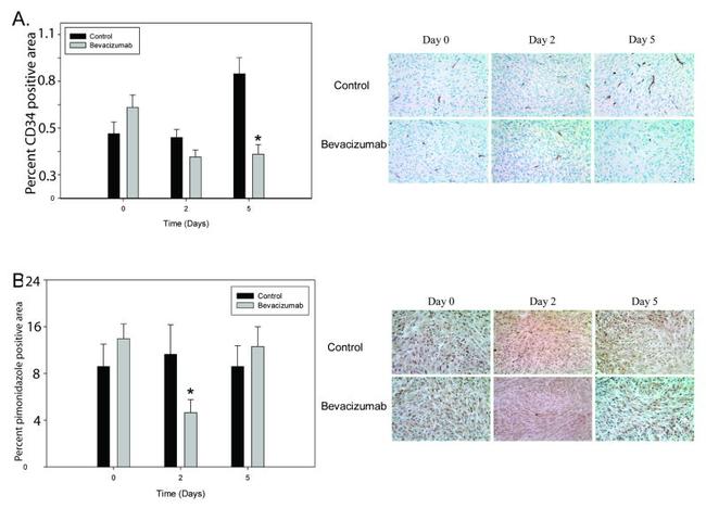 CD34 Antibody in Immunohistochemistry (IHC)