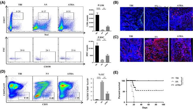 CD41a Antibody in Immunohistochemistry (IHC)