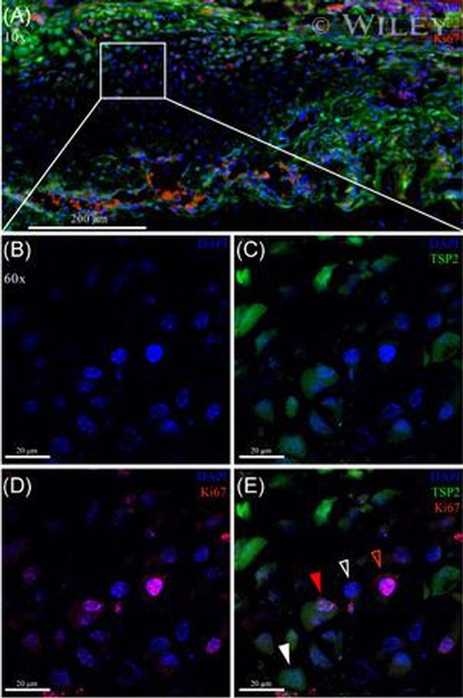 Ki-67 Antibody in Immunocytochemistry (ICC/IF)