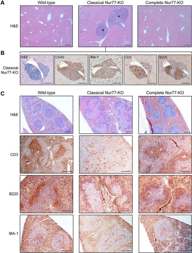 CD45 Antibody in Immunohistochemistry (IHC)