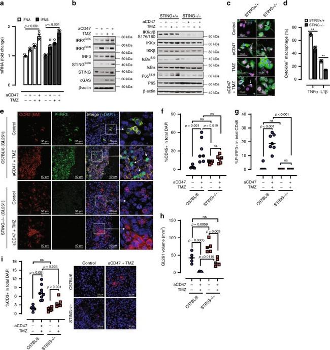 CD45 Antibody in Immunohistochemistry (IHC)