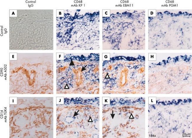 CD68 Antibody in Immunohistochemistry (IHC)