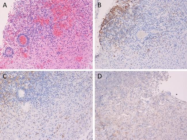 SIGLEC15 Antibody in Immunohistochemistry (IHC)