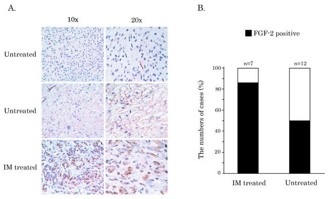 CD117 (c-Kit) Antibody in Immunohistochemistry (IHC)