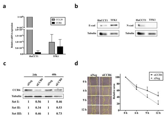 CD196 (CCR6) Antibody in Western Blot (WB)