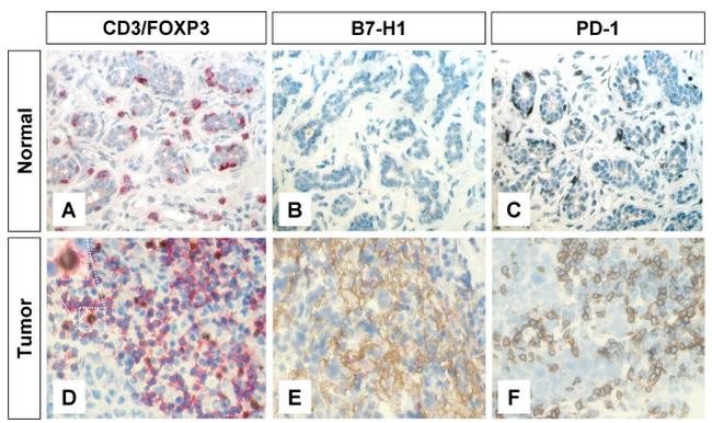 CD279 (PD-1) Antibody in Immunohistochemistry (IHC)