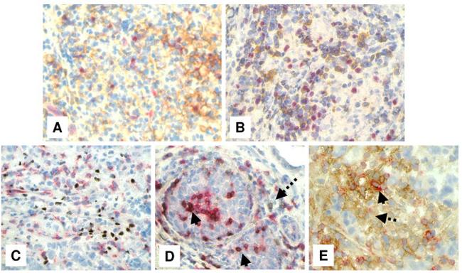 CD279 (PD-1) Antibody in Immunohistochemistry (IHC)