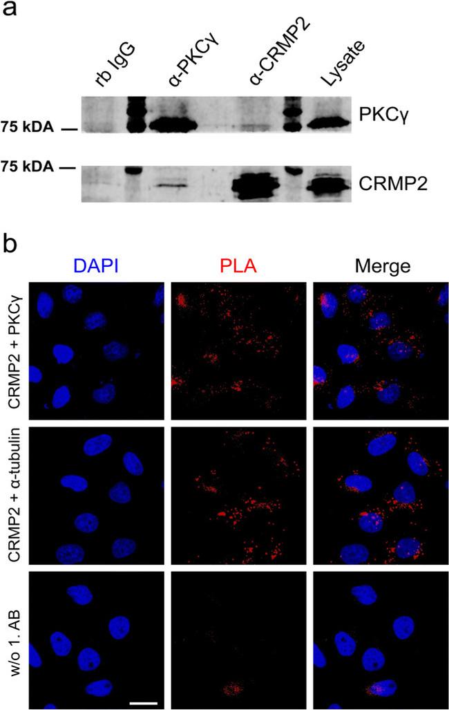 alpha Tubulin Antibody in Immunocytochemistry, Proximity Ligation Assay (PLA) (ICC/IF, PLA)