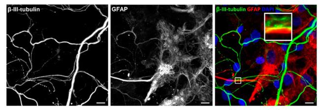 beta-3 Tubulin Antibody in Immunocytochemistry (ICC/IF)