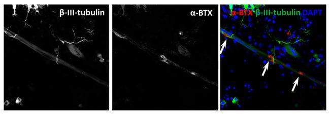 beta-3 Tubulin Antibody in Immunocytochemistry (ICC/IF)