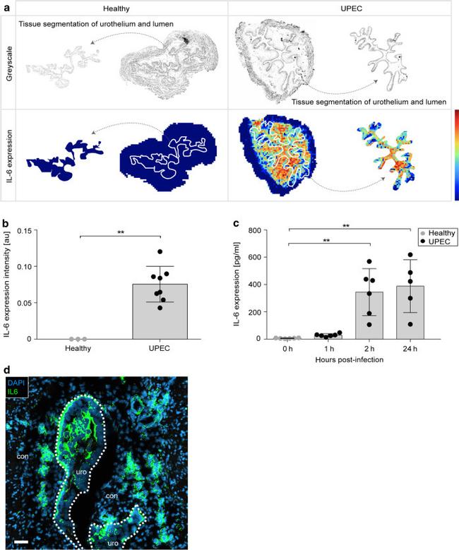 IL-6 Antibody in Immunohistochemistry, ELISA (IHC, ELISA)