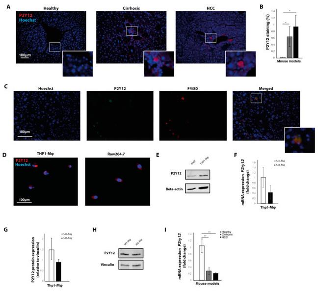 P2Y12 Antibody in Western Blot, Immunocytochemistry, Immunohistochemistry (WB, ICC/IF, IHC)