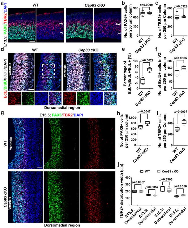 EOMES Antibody in Immunocytochemistry (ICC/IF)