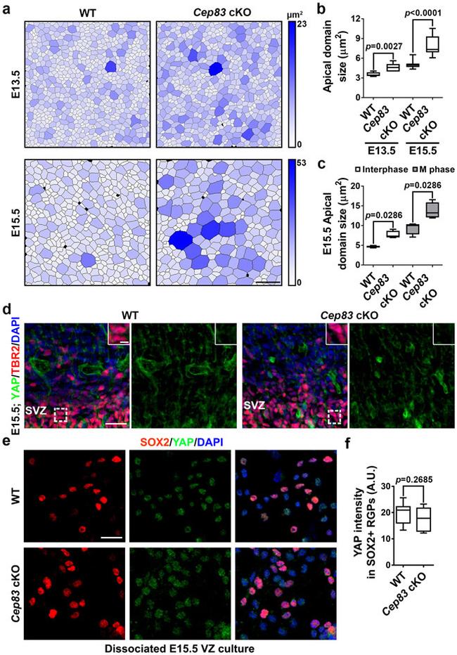 EOMES Antibody in Immunocytochemistry (ICC/IF)