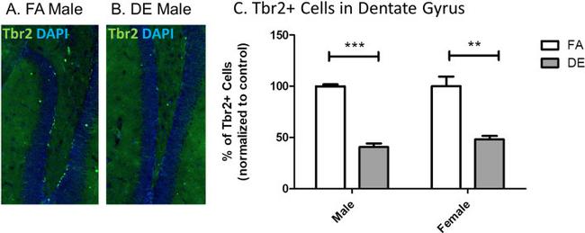 EOMES Antibody in Immunohistochemistry (IHC)