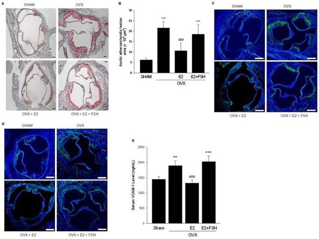 VCAM-1 Antibody in Immunohistochemistry (IHC)