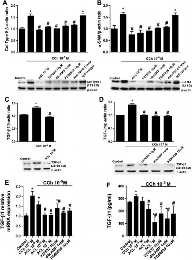 Collagen I Antibody in Western Blot (WB)