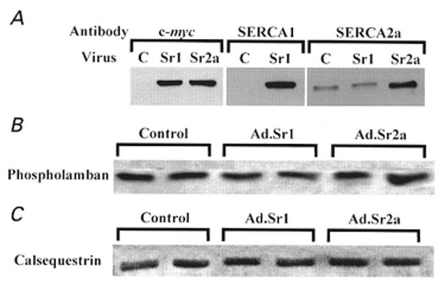 Calsequestrin Antibody in Western Blot (WB)