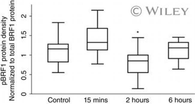 BRF1 Antibody in Immunoprecipitation (IP)