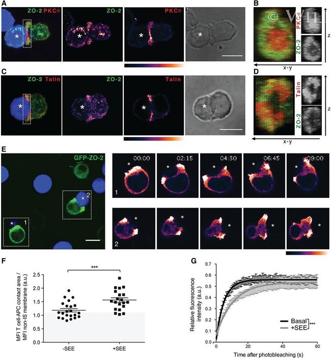 ZO-2 Antibody in Immunocytochemistry (ICC/IF)