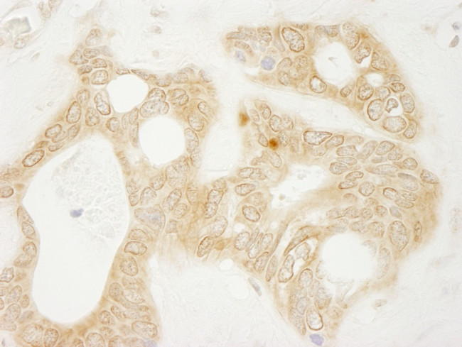 vPARP Antibody in Immunohistochemistry (IHC)