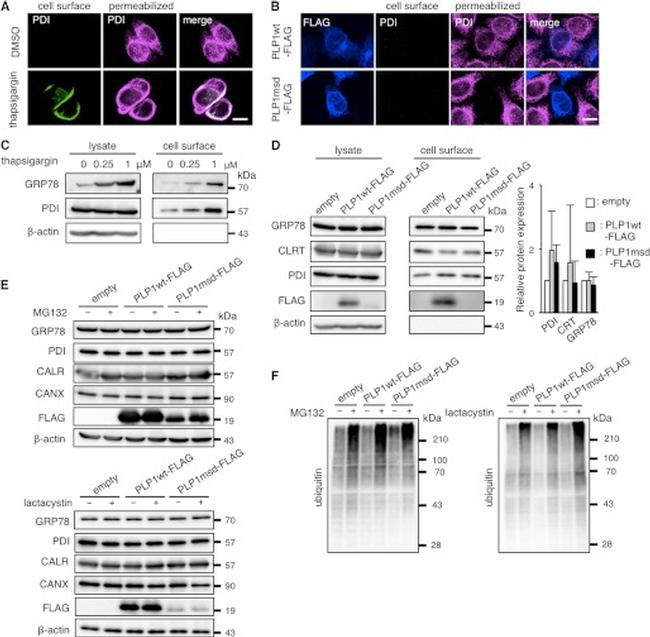 PDI Antibody in Immunocytochemistry (ICC/IF)