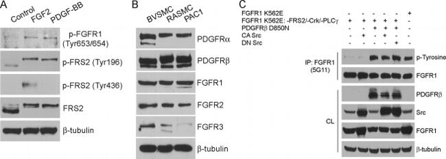 Phospho-FGFR1 (Tyr653, Tyr654) Antibody in Western Blot (WB)