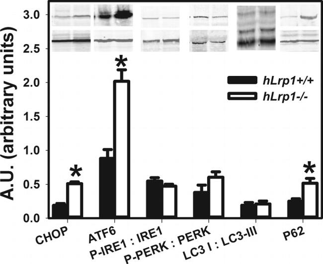 Phospho-IRE1 alpha (Ser724) Antibody in Western Blot (WB)