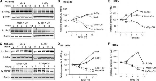 IL-1RAcP Antibody in Western Blot (WB)