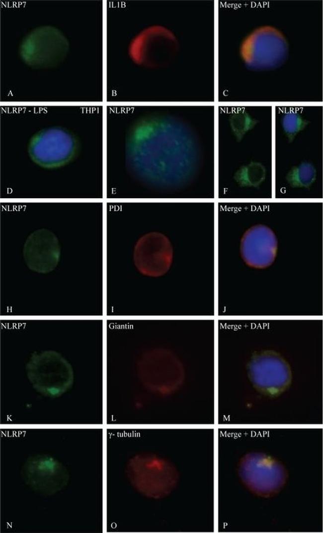 PDI Antibody in Immunocytochemistry (ICC/IF)