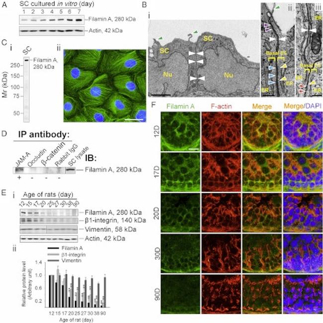 JAM-A (CD321) Antibody in Immunoprecipitation (IP)