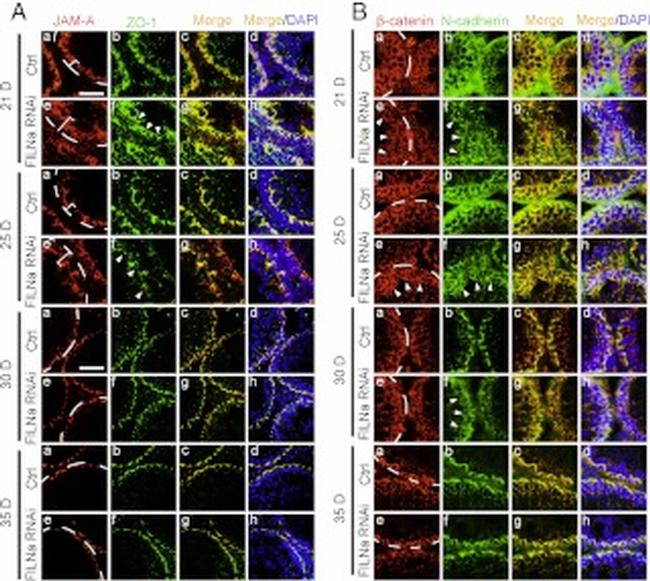 beta Catenin Antibody in Immunohistochemistry (IHC)