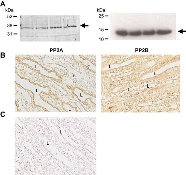 Phospho-Aquaporin 2 (Ser264) Antibody in Western Blot (WB)