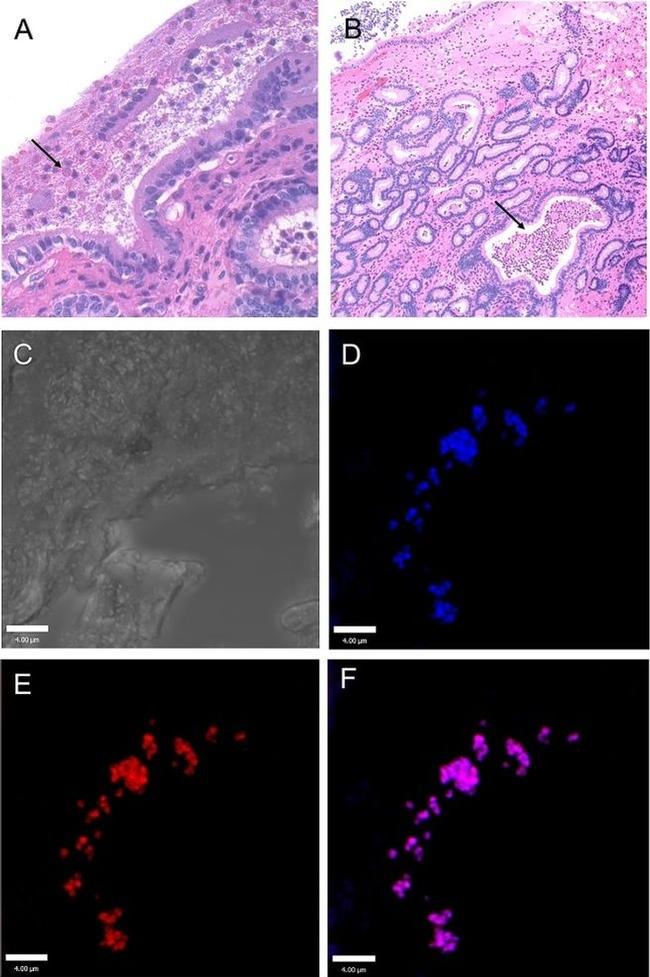 Pseudomonas Antibody in Immunohistochemistry (IHC)