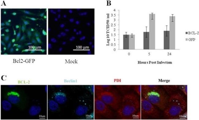 PDI Antibody in Immunocytochemistry (ICC/IF)