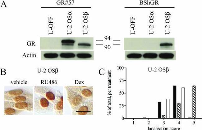 Glucocorticoid Receptor beta Antibody in Western Blot (WB)